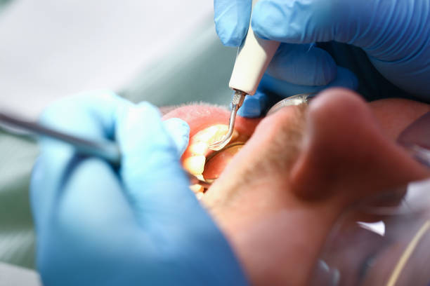 Best Emergency Treatment for Jaw Pain or Injury in Morocco, IN