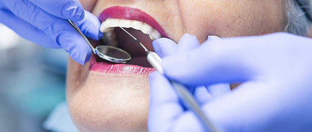 Best Lost Filling or Crown Replacement in Morocco, IN